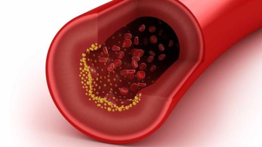 Descubre la verdad sobre tu salud cardiovascular: desvelando los secretos detrás del colesterol total